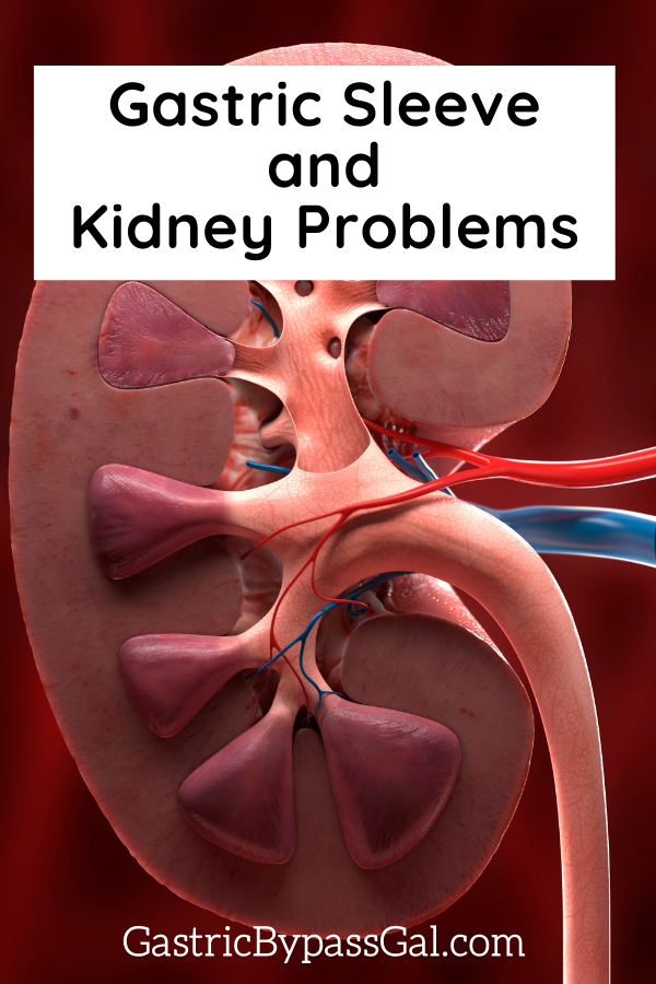 Gastric Sleeve and Kidney Problems article cover image