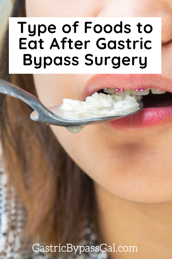Type of Foods to Eat After Gastric Bypass Surgery article featured image